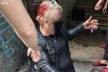 &lt;p&gt;Dobermani brutalno izgrizli ženu u centru Sarajeva&lt;/p&gt;
